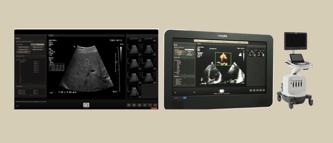 Sistema de Ultrassom AFFINITI 50